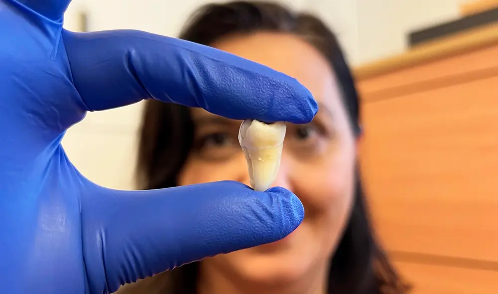 Descubren un fármaco que estimula el crecimiento natural de un tercer juego de dientes ocultos en nuestra boca. Foto: Kings College London