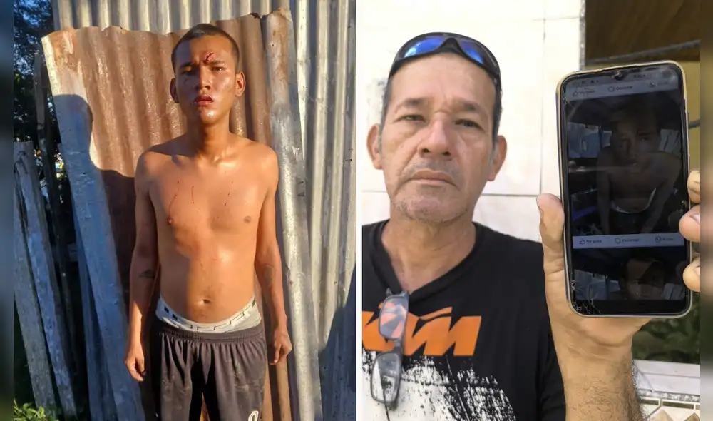 Fernando Torres Vilchez, padre de la víctima, denuncia agresión a su hijo. Foto: Yazmín Araujo