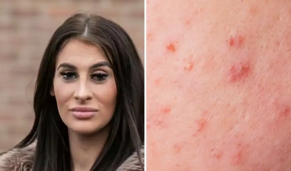 La mujer busca ayuda de especialistas en enfermedades raras mientras su lucha por una vida normal continúa. Foto: composición LR/Freepik/SWNS La mujer busca ayuda de especialistas en enfermedades raras mientras su lucha por una vida normal continúa. Foto: composición LR/Freepik/SWNS