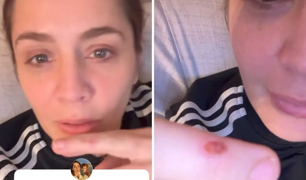 En una historia de Instagram se le vió a Yidda Eslava con cortes en la mano. Foto: composición LR/captura de Instagram