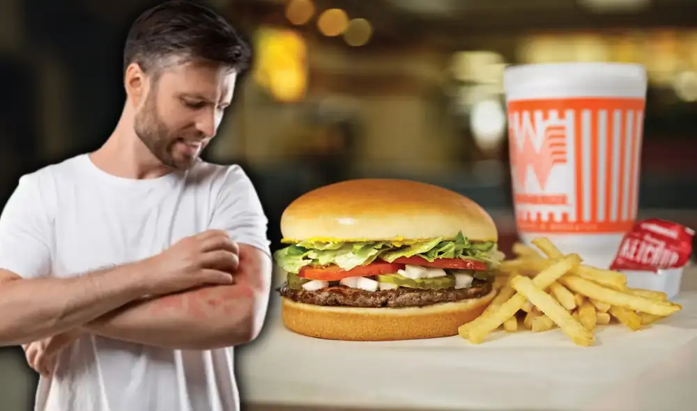 Texano demanda a Whataburger por reacción alérgica a cebolla. Texano demanda a Whataburger por reacción alérgica a cebolla.