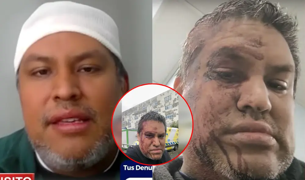 Pese a encontrarse malherido por la agresión que sufrió por ciudadanos chilenos, el peruano relató que los paramédicos se negaron a atenderlo a tiempo. Foto: composición LR/24 Horas