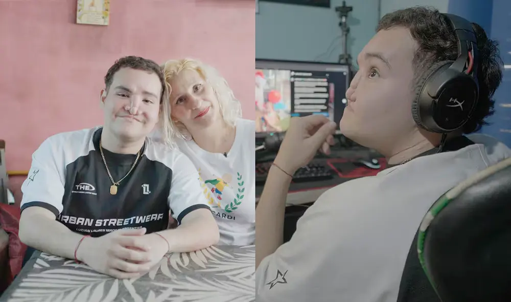 Tomás Ricardi fue diagnosticado con leucemia, un hongo mucormicótico le comió su rostro y puso su vida en riesgo a los 15 años. Foto: TN