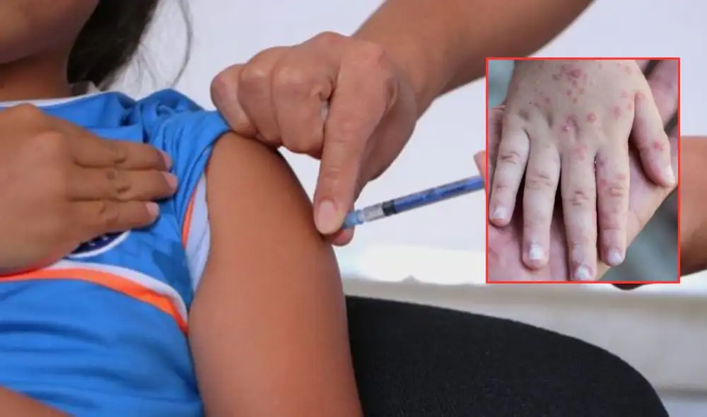 Personal médico aplica vacuna SRP en campaña contra el brote de sarampión.