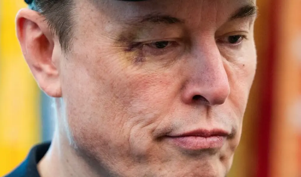 Elon Musk apareció con un ojo morado en la Casa Blanca