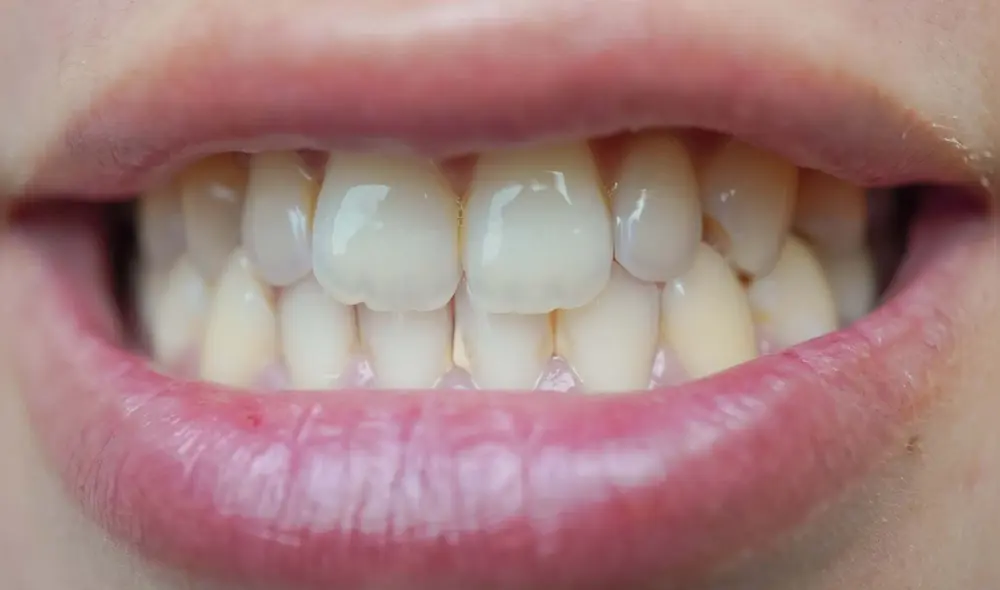 Esta bebida contiene vitamina C, vitamina E y compuestos fenólicos que ayuda a los dientes Esta bebida contiene vitamina C, vitamina E y compuestos fenólicos que ayuda a los dientes