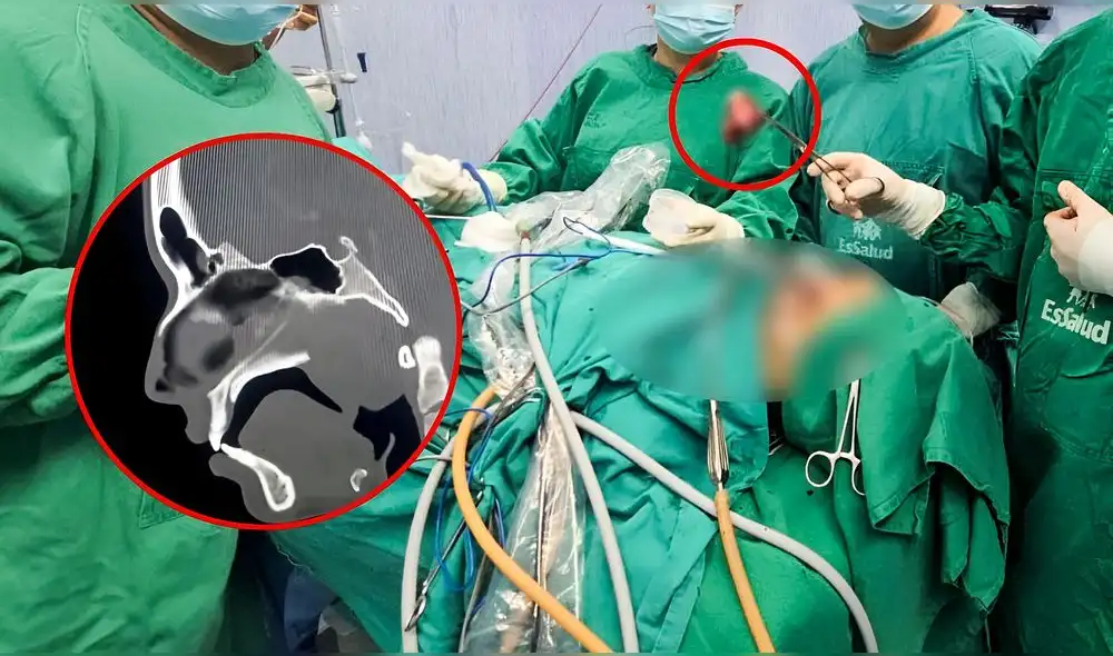 La intervención se realizó en el Hospital Virgen de la Puerta. Foto: Composición LR/EsSalud