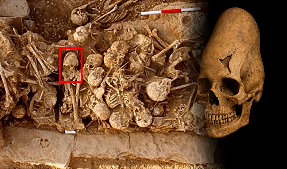 El milenario cráneo tiene al rededor de 6 mil millones de años de antigüedad revela una modificación craneal tradicional. Foto: Composición LR/ Zohreh Prehistoric Project