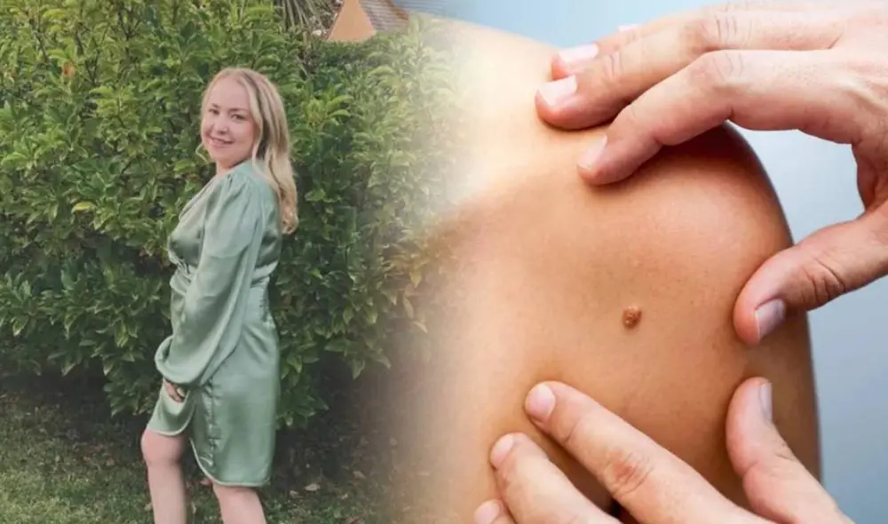 Mujer descubrió que tenía cáncer tras usar camas solares en su juventud. Foto: composición LR/ X Mujer descubrió que tenía cáncer tras usar camas solares en su juventud. Foto: composición LR/ X