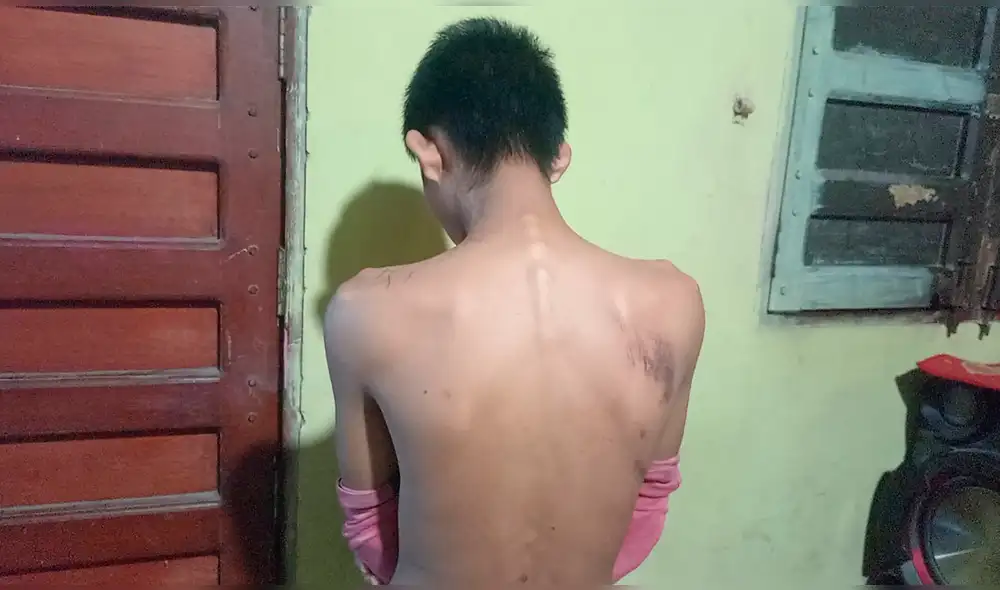 Soldado denunció que fue golpeado y que fue denunciado por dos de sus superiores. Foto: Difusión Soldado denunció que fue golpeado y que fue denunciado por dos de sus superiores. Foto: Difusión