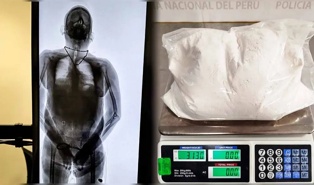 Escáner corporal evidenció bultos extraños en el torso y extremidades del pasajero que alertó a autoridades del aeropuerto Jorge Chávez.