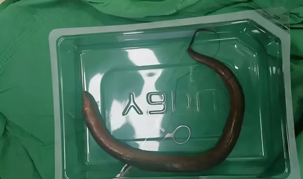 Anguilas excavan en barro, lo que explicaría su daño en tejidos humanos. Anguilas excavan en barro, lo que explicaría su daño en tejidos humanos.