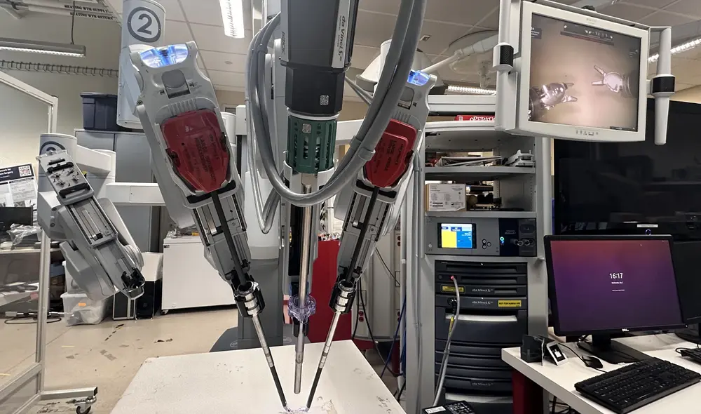 Un robot logró extraer una vesícula biliar sin la ayuda humana en Estados Unidos.