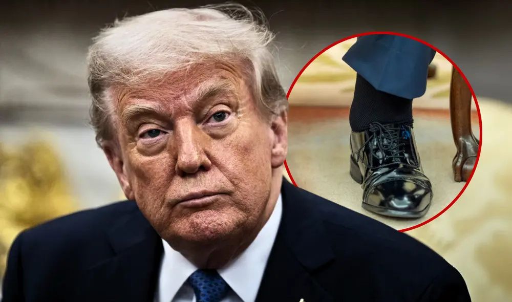 Trump fue diagnosticado con insuficiencia venosa crónica, enfermedad común. Foto: EFE