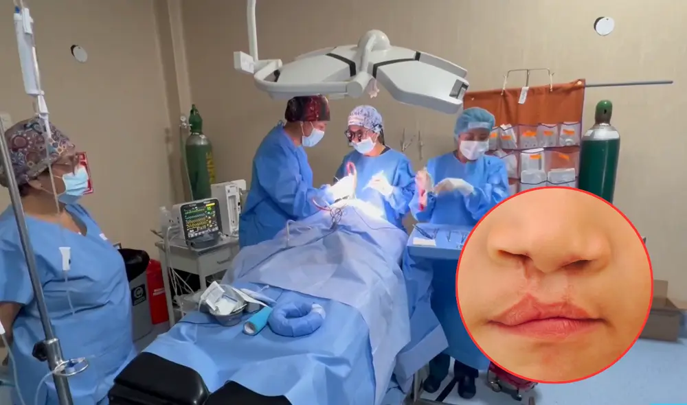 La Campaña Operación Sonrisa se desarrolla en Arequipa. Foto: Composición LR/ Canal N