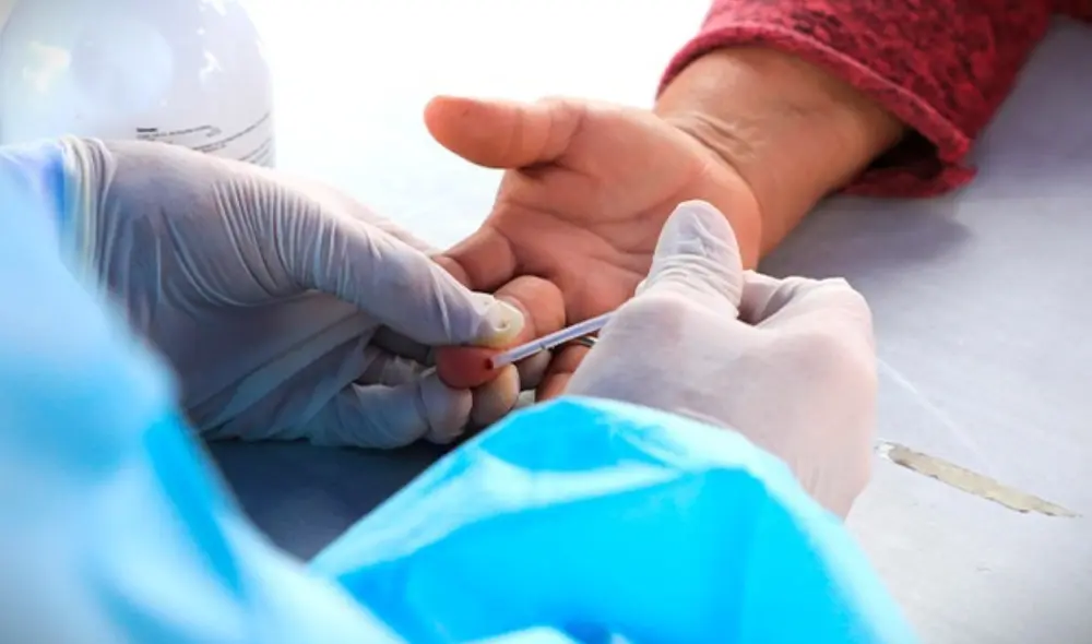 Si presenta algún síntoma, debe acercarse al centro de salud.