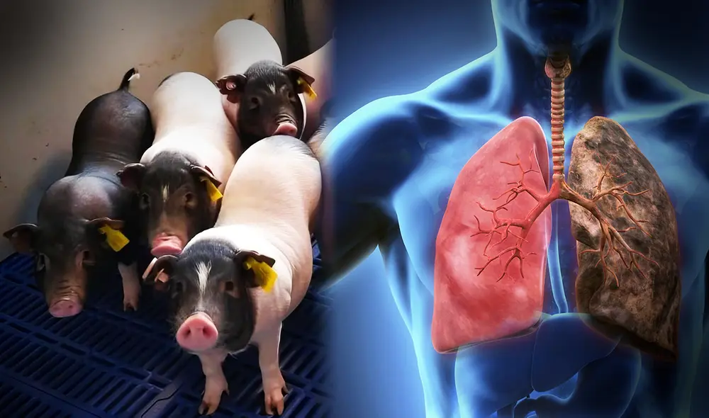 China hace historia tras trasplantar un pulmón de cerdo a un humano con éxito. Foto: Composición LR
