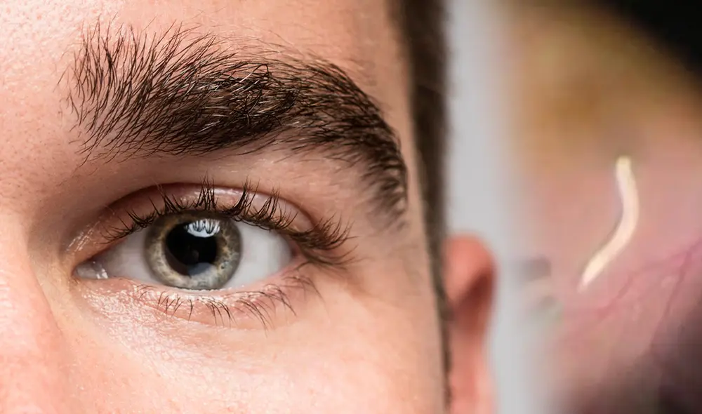 Un hombre en India sufría inflamación ocular y descubren un parásito de perros y gatos en su ojo. Foto: Composición LR