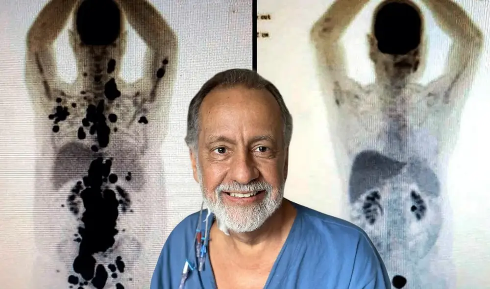 Paulo Peregrino sufrió más de 40 quimeoterapias. Paulo Peregrino sufrió más de 40 quimeoterapias.