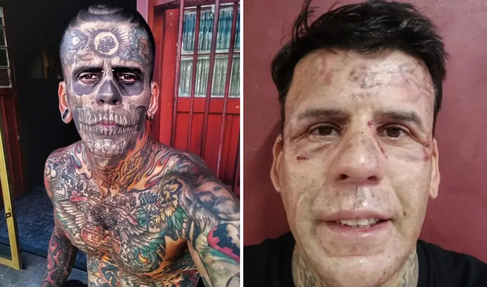 Leandro de Souza tuvo que atravesar un duro proceso de cirugía para eliminar sus 170 tatuajes en todo el cuerpo.