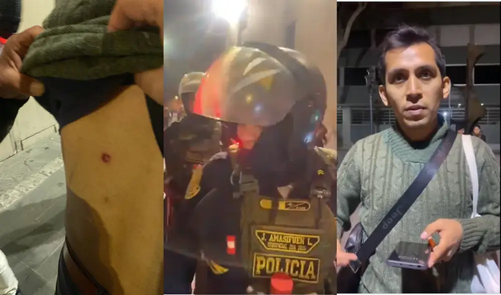 Periodista Diego Quispe denunció ataques de perdigones por parte de la PNP. Foto: Captura