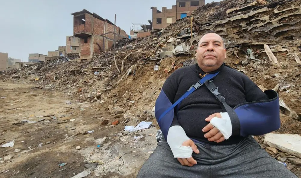 Vecino de SJM se fracturó ambas muñecas al intentar salvar a sus mascotas del incendio