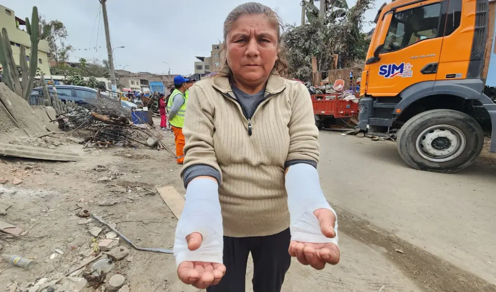 Una mujer de San Juan de Miraflores sufrió quemaduras en los brazos cuando intentaba rescatar sus pertenencias durante el incendio en Pamplona Alta.