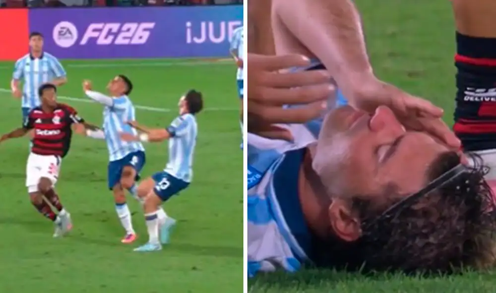 Santiago Sosa terminó con el ojo hinchado producto del codazo de Marcos Rojo. Foto: composición de LR/captura de ESPN Santiago Sosa terminó con el ojo hinchado producto del codazo de Marcos Rojo. Foto: composición de LR/captura de ESPN