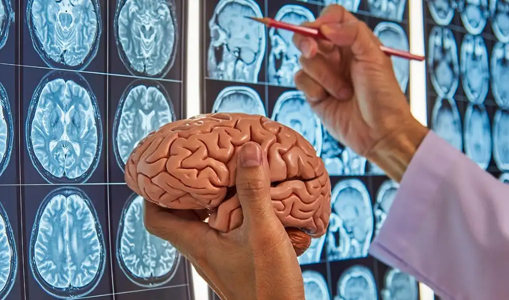 Los primeros síntomas del Alzheimer suelen ser invisibles, y es difícil saber cuándo comienza el deterioro de la memoria. Foto: IStock