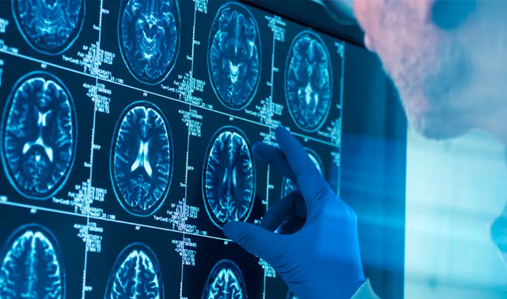 Los hallazgos ayudarían a entender los factores que influyen en los trastornos mentales que suelen aparecer en la adolescencia. Foto: IStock Los hallazgos ayudarían a entender los factores que influyen en los trastornos mentales que suelen aparecer en la adolescencia. Foto: IStock