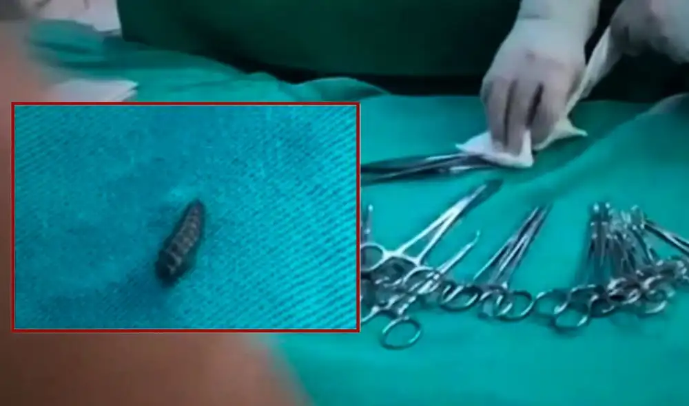 Alarma en el Hospital Materno Infantil El Carmen de Huancayo tras la difusión de un video que muestra una larva de mosca cayendo durante una intervención quirúrgica. Alarma en el Hospital Materno Infantil El Carmen de Huancayo tras la difusión de un video que muestra una larva de mosca cayendo durante una intervención quirúrgica.