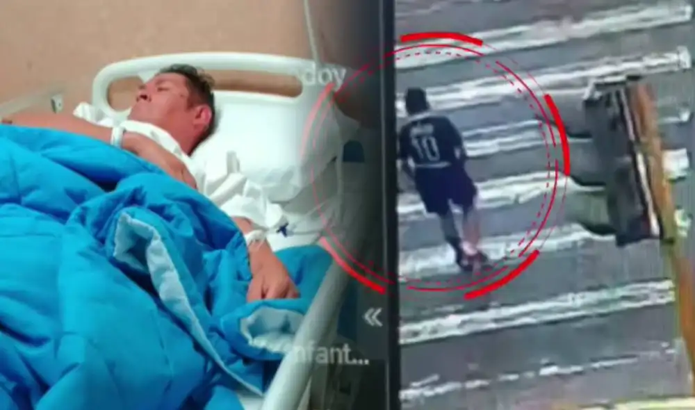 El hombre sufrió una fractura en la pierna tras el accidente.