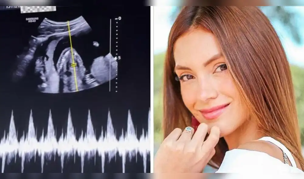 Darlene Rosas sorprendió al mostrar por primera vez su embarazo de seis meses. Darlene Rosas sorprendió al mostrar por primera vez su embarazo de seis meses.