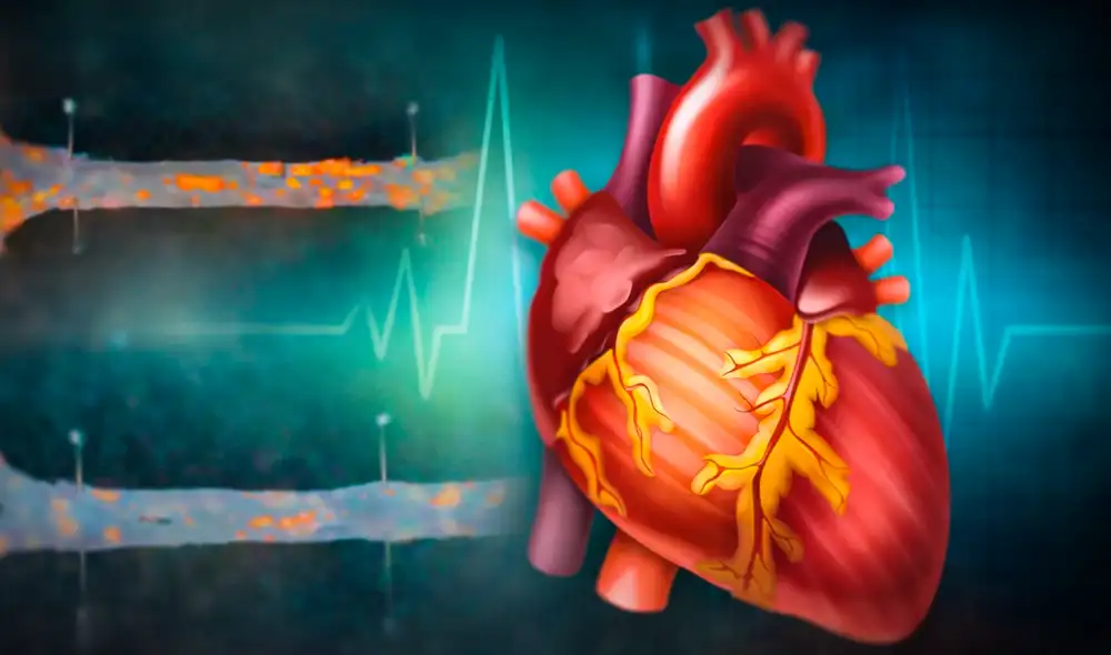 La meta principal del tratamiento es la reducción del volumen de la placa que obstruye el flujo sanguíneo y la mitigación de la inflamación arterial, según científicos de EE.UU.