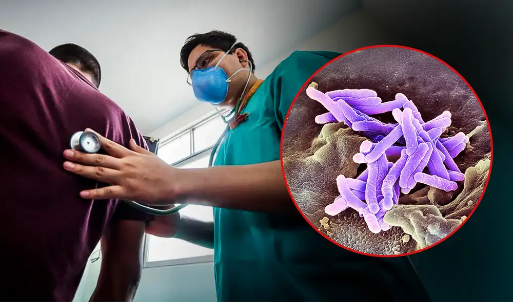 Cada 24 de marzo, el mundo conmemora el Día Mundial de la Lucha contra la Tuberculosis.