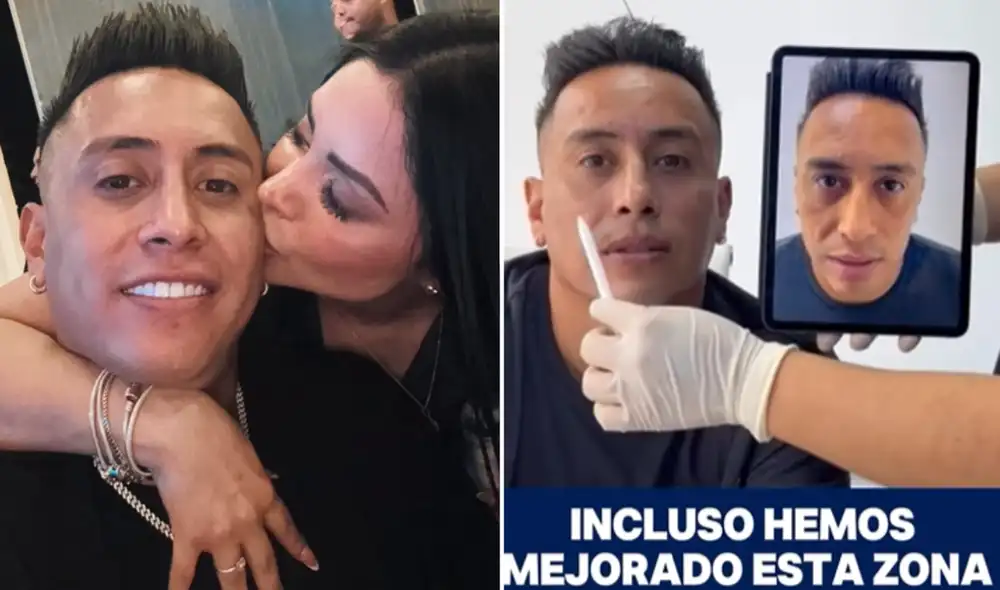 Christian Cueva se somete a nuevo retoque estético. Foto: composición LR/Instagram
