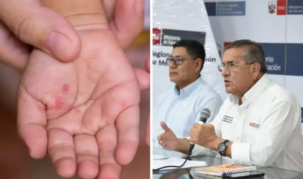 Autoridades se pronunciaron ante incremento de casos por virus. Autoridades se pronunciaron ante incremento de casos por virus.