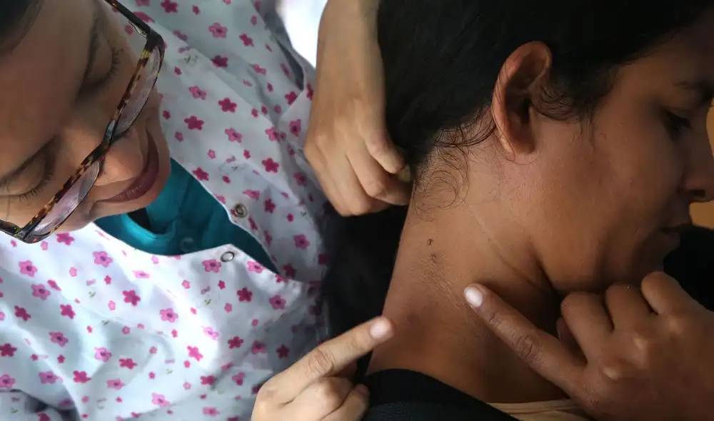 Junín lidera con 72 casos sospechosos de cáncer de piel durante la campaña “Salva tu piel”, realizada entre febrero y abril en Perú. Esta iniciativa destaca el impacto de la radiación ultravioleta. Junín lidera con 72 casos sospechosos de cáncer de piel durante la campaña “Salva tu piel”, realizada entre febrero y abril en Perú. Esta iniciativa destaca el impacto de la radiación ultravioleta.