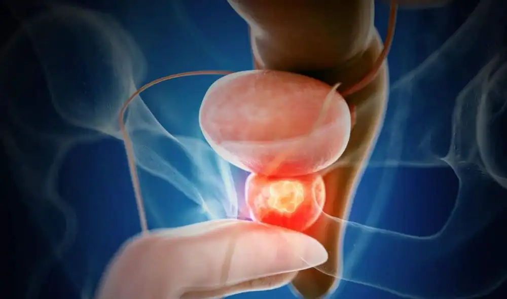 Un ensayo clínico internacional demuestra que una terapia combinada con enzalutamida y talazoparib frena la progresión del cáncer de próstata avanzado.