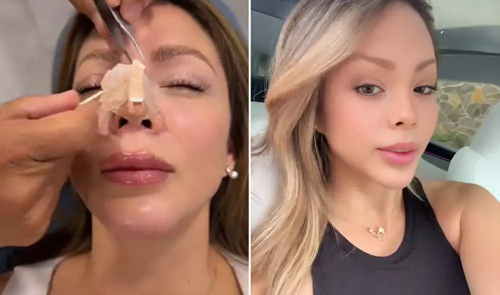 Sheyla Rojas se sometió a nueva cirugía estética. Foto: composición LR/TikTok