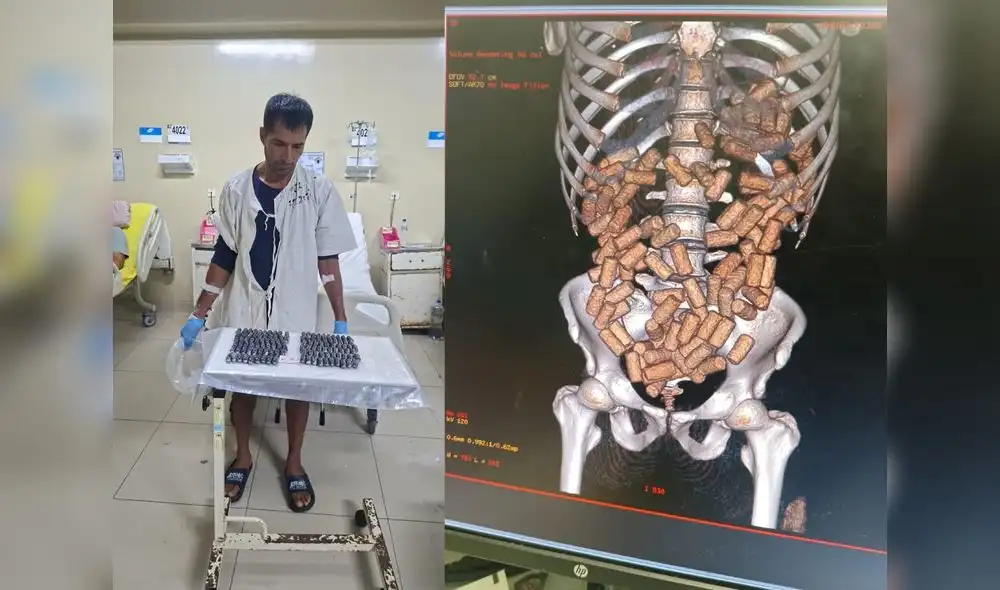 Vicitación Abanto llevaba 119 cápsulas con cocaína.