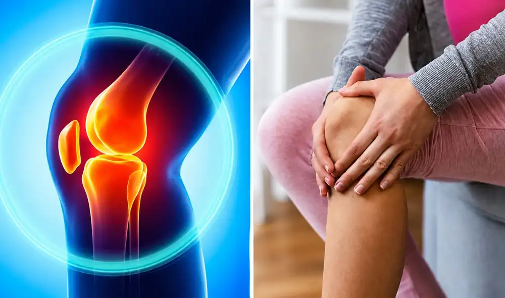 Un estudio en casi 200 pacientes mostró que esta intervención mínimamente invasiva redujo el dolor por artrosis de rodilla. Un estudio en casi 200 pacientes mostró que esta intervención mínimamente invasiva redujo el dolor por artrosis de rodilla.