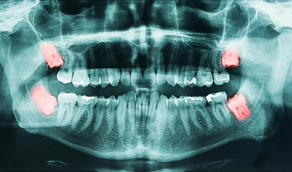 Un experimento con dientes de ratón revela cómo se determina el tamaño de los molares durante el desarrollo. Un experimento con dientes de ratón revela cómo se determina el tamaño de los molares durante el desarrollo.