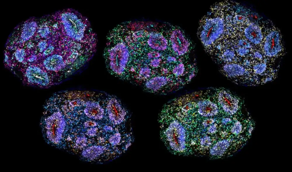 Varias secciones de un organoide, desarrolladas para simular procesos de maduración cerebral. Foto: Irene Faravelli y Noelia Antón Bolaños