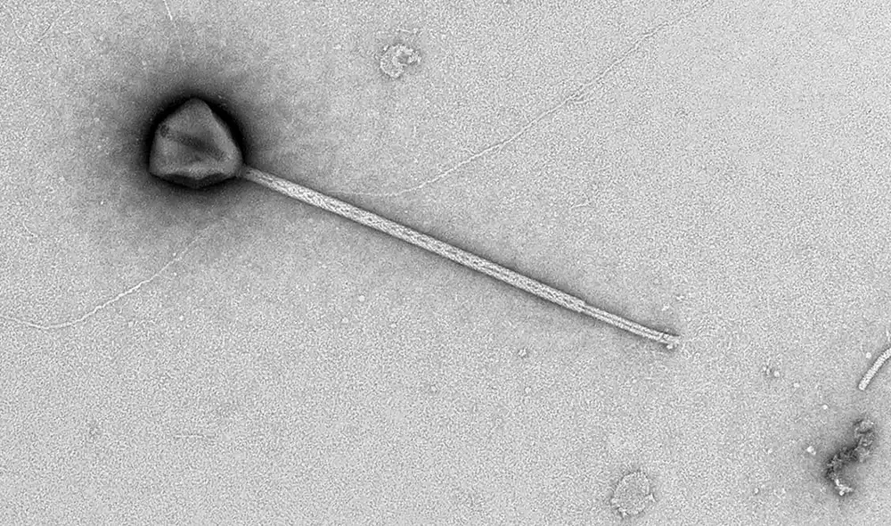 Investigadores han descubierto PelV-1, un virus gigante del océano Pacífico Norte que posee el apéndice más largo entre los virus conocidos, desafiando la anatomía viral previa. Investigadores han descubierto PelV-1, un virus gigante del océano Pacífico Norte que posee el apéndice más largo entre los virus conocidos, desafiando la anatomía viral previa.