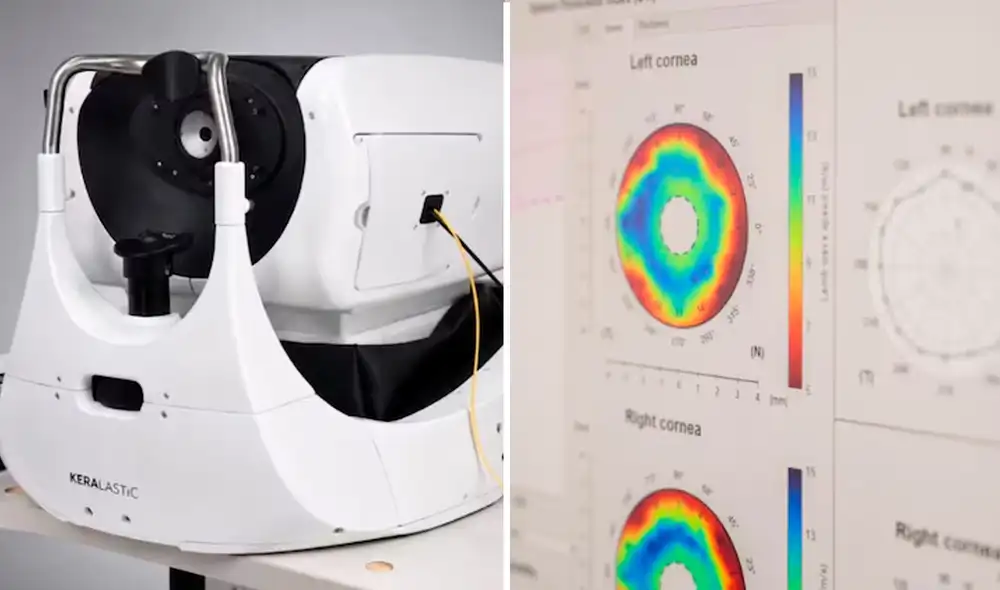 La nueva tecnología para prevenir la ceguera ya está en fase clínica. La nueva tecnología para prevenir la ceguera ya está en fase clínica.