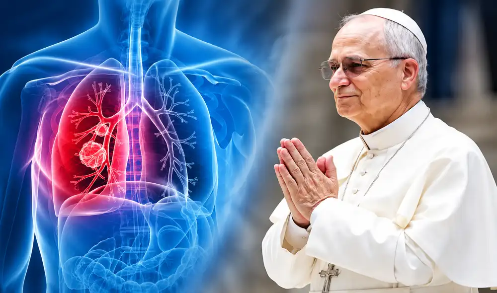 Los médicos explicaron que el adenocarcinoma pulmonar representa el 40% de los tumores malignos de pulmón y puede afectar tanto a fumadores como a no fumadores.