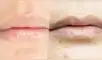 Conoce los factores que podrían llevar a que los labios se puedan irritar y hasta quebrar. Foto: Composición La República