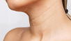 ¿Por qué me aparecen líneas en el cuello y cómo atenuarlas?