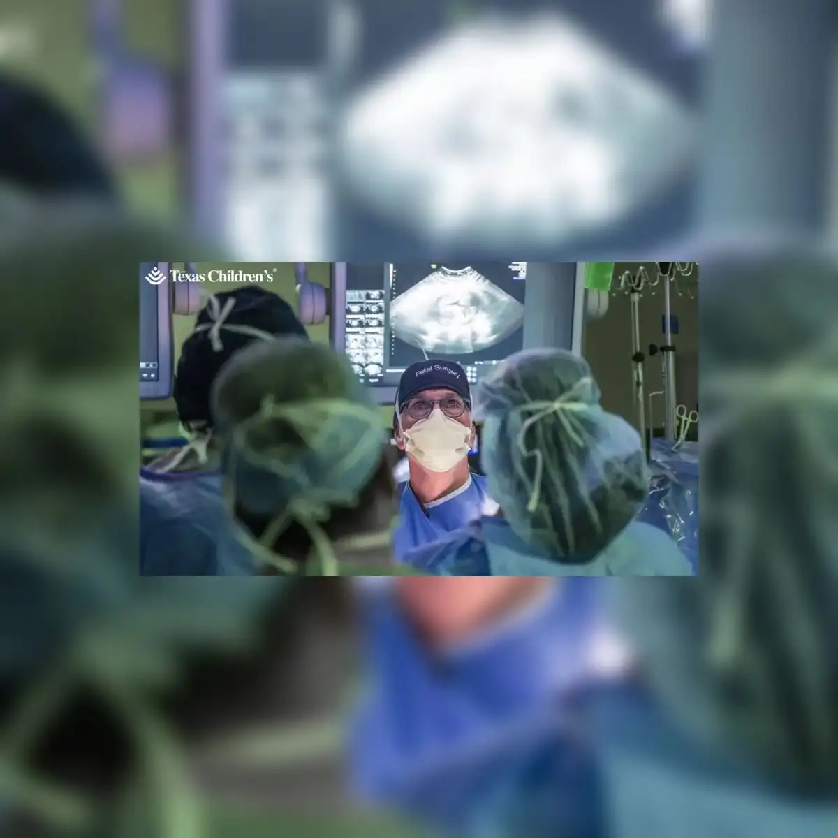Un equipo médico logró un hito en medicina prenatal al operar a un bebé con malformación congénita dentro del útero.